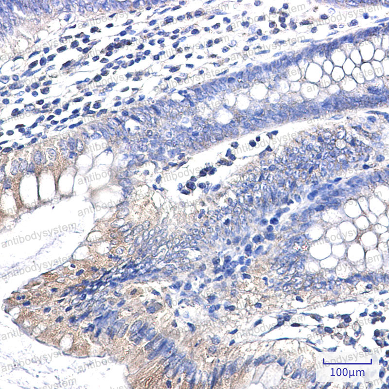 Anti-CLTC Antibody (R2B78)