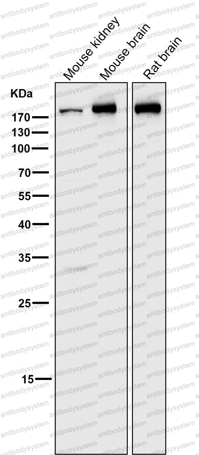 Anti-CLTC Antibody (R2B77)