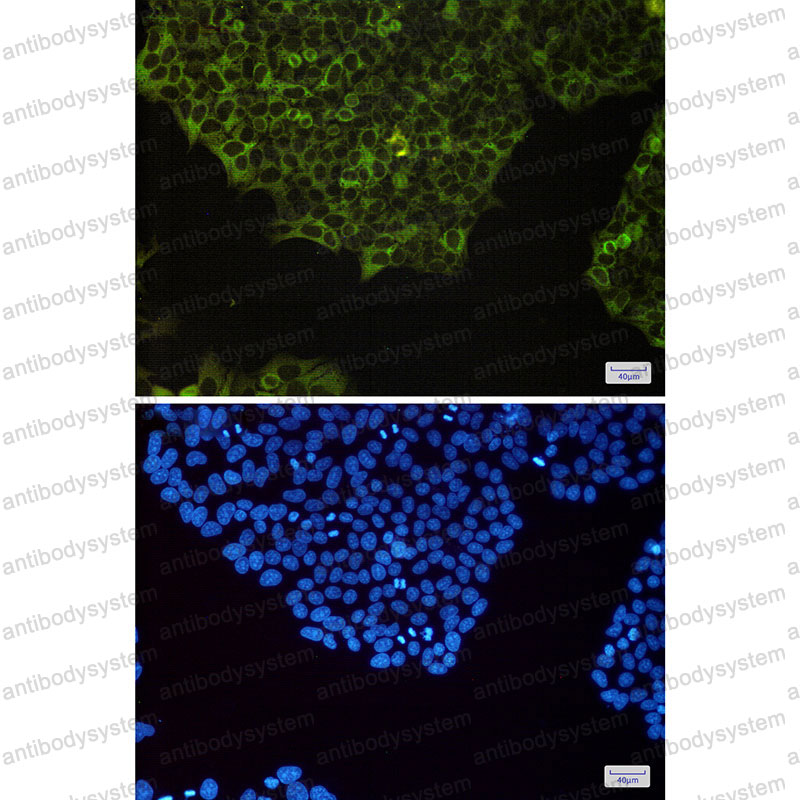 Anti-NFKB2 Antibody (R2B82)
