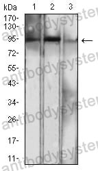 Anti-NFKB2 Antibody (R3Q17)