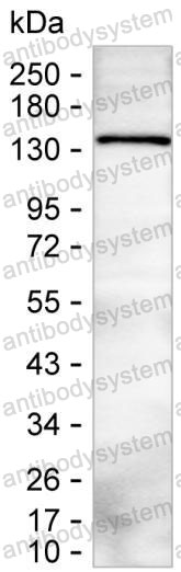 Anti-PLCB2 Antibody (R3Q20)