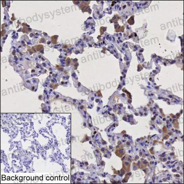 Anti-PLCB2 Antibody (R3Q19)