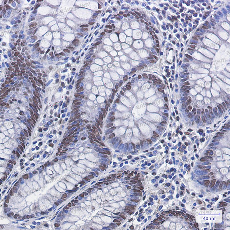 Anti-Phospho-MDM2 (Ser166) Antibody (R2B84)