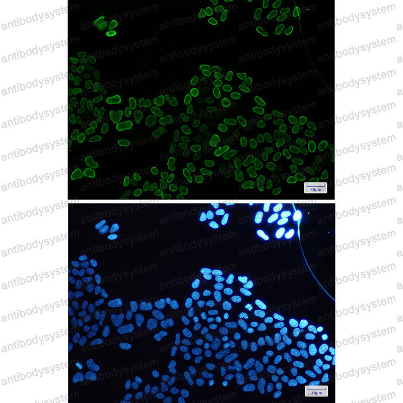 Anti-E2F1/RBBP3 Antibody (R2B86)