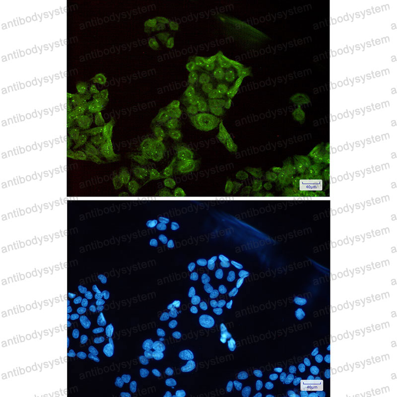 Anti-SET Antibody (R2B88)