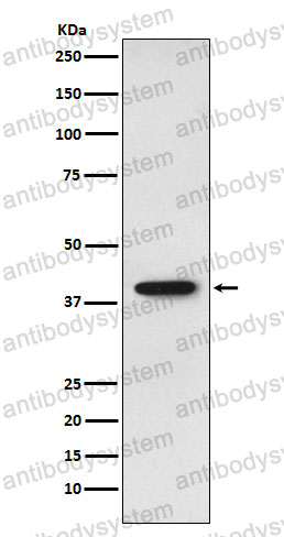 Anti-SET Antibody (R2B87)