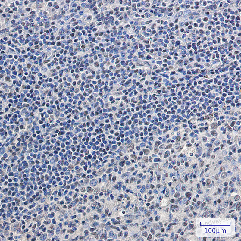 Anti-SRSF2/SC-35 Antibody (R2B89)