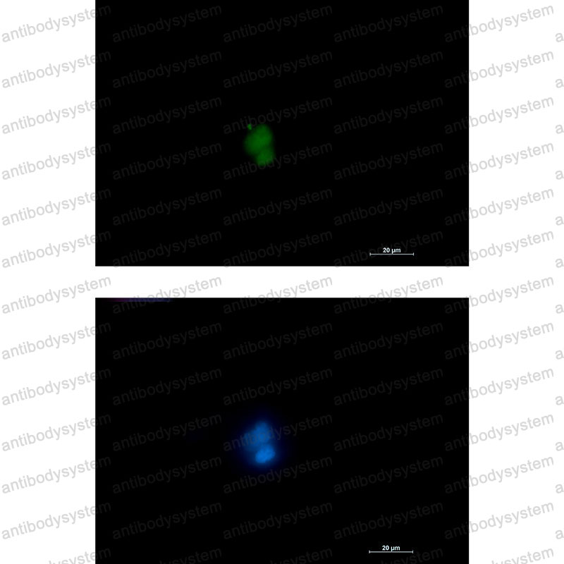 Anti-RUNX1 Antibody (R2B90)