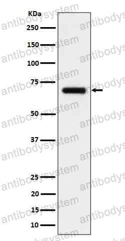 Anti-CD125/IL5RA Antibody (R2B92)