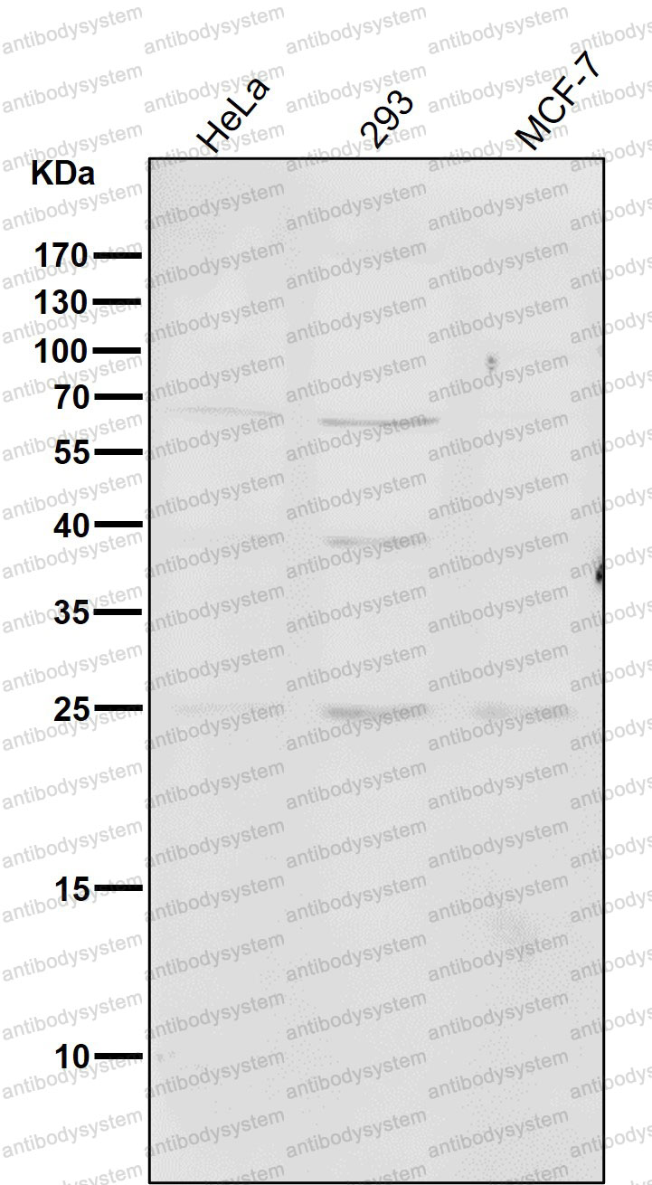 Anti-PMP22 Antibody (R2B93)