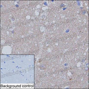 Anti-ANK2 Antibody (R3Q38)