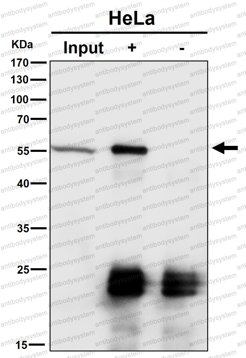 Anti-CAP1 Antibody (R2B94)