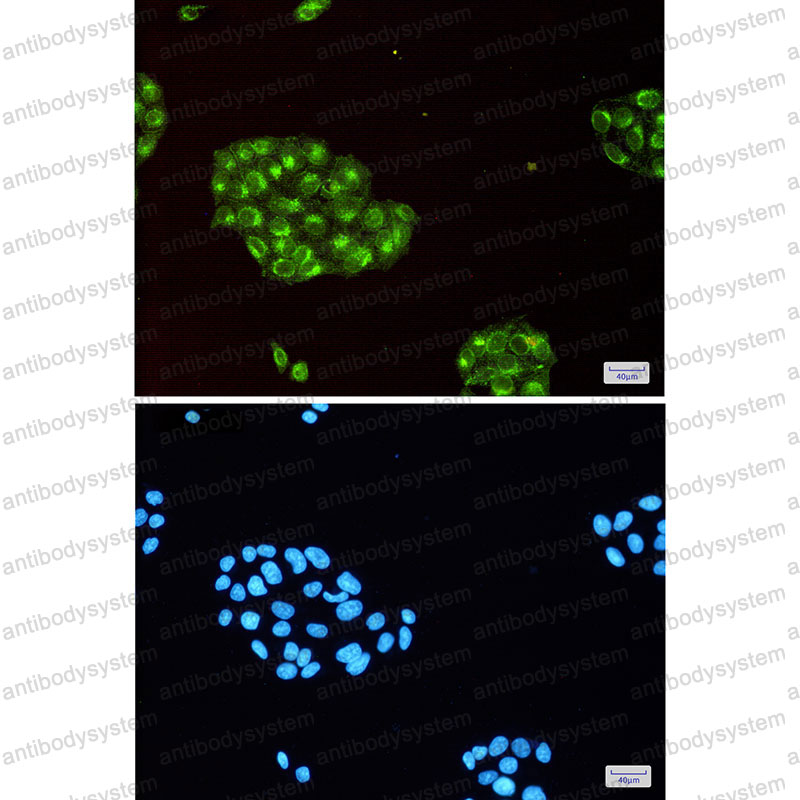 Anti-IFITM3 Antibody (R2B97)