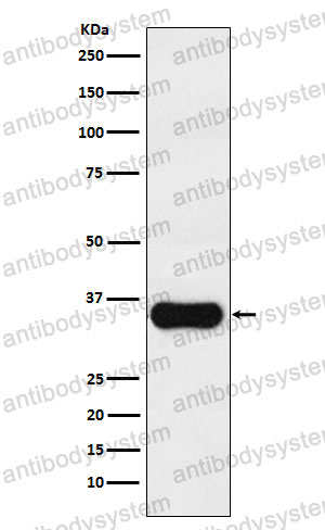 Anti-MC1R Antibody (R2B98)