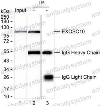 Anti-EXOSC10 Antibody (R3Q41)