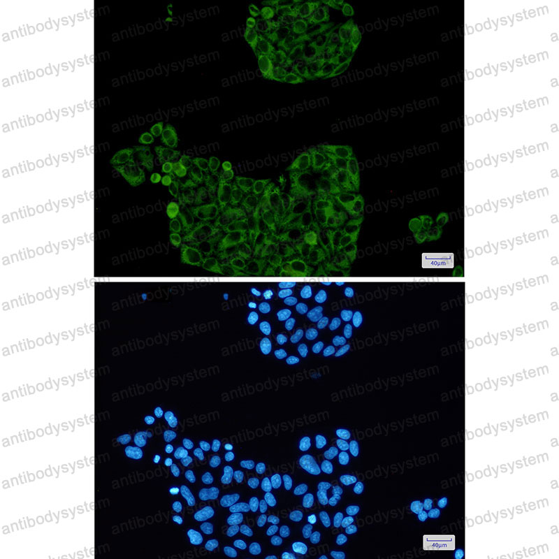 Anti-PFKP Antibody (R2B99)