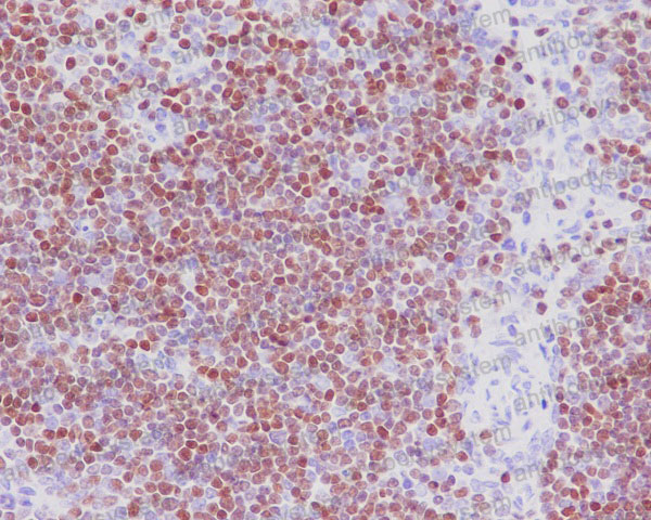Anti-SATB1 Antibody (R1A38)
