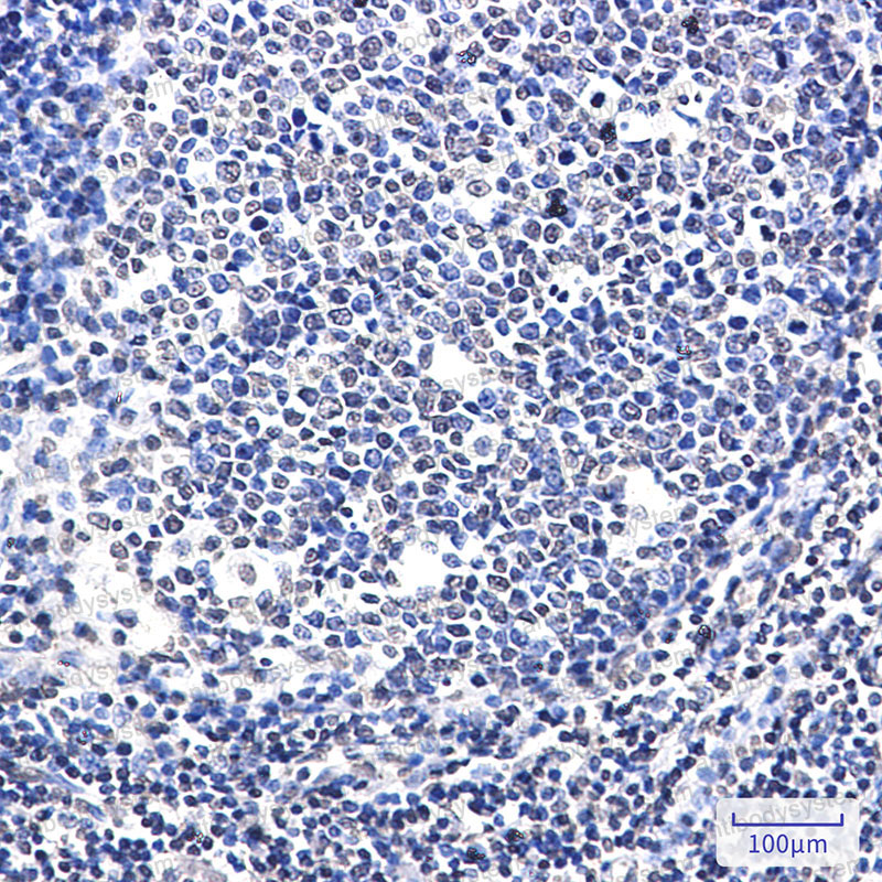 Anti-SATB1 Antibody (R2C01)
