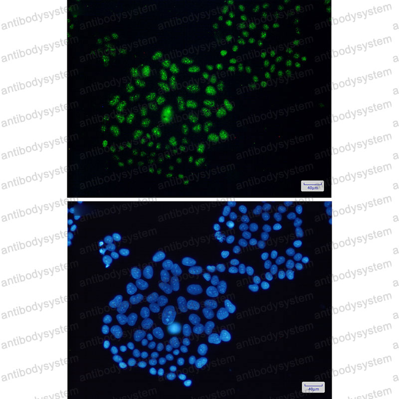 Anti-EWSR1 Antibody (R2C04)