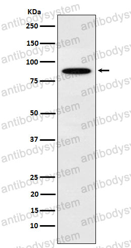 Anti-EWSR1 Antibody (R2C02)