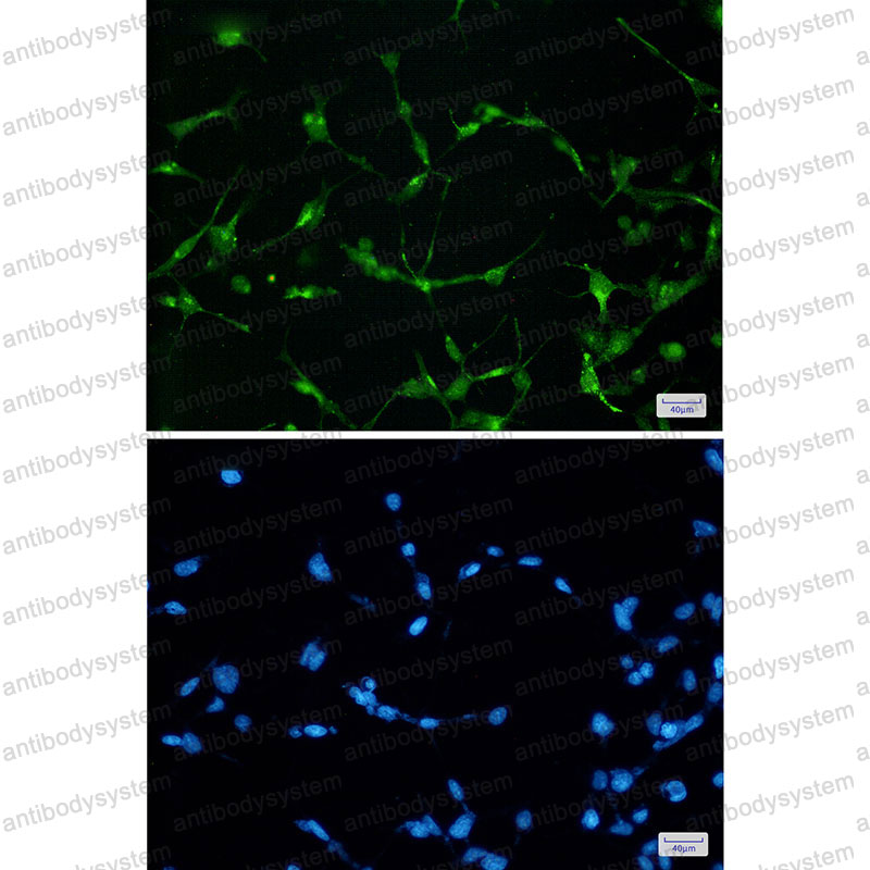 Anti-EWSR1 Antibody (R2C03)