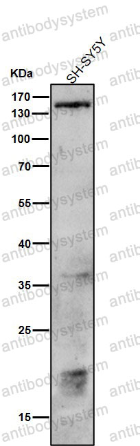 Anti-Phospho-PLCB3 (S537) Antibody (R2C07)