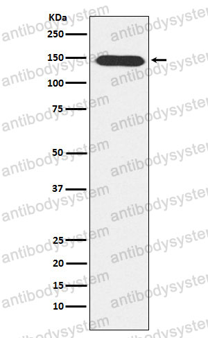 Anti-PLCB3 Antibody (R2C06)