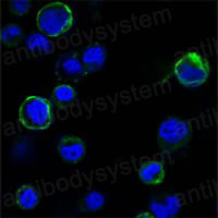 Anti-ROR1/NTRKR1 Antibody (R3Q51)