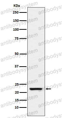 Anti-TAGLN Antibody (R2C08)