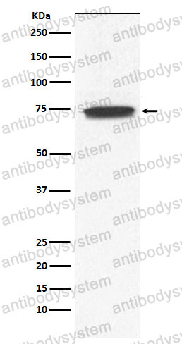 Anti-GUCY1A1 Antibody (R2C10)