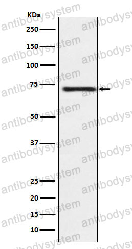 Anti-GUCY1B1 Antibody (R2C11)
