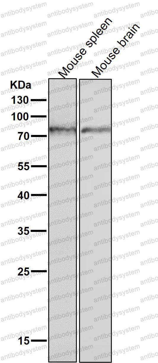 Anti-Phospho-PRKCE (S729) Antibody (R2C13)