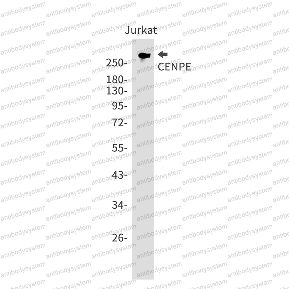 Anti-CENPE Antibody (R2C15)