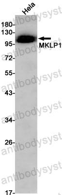 Anti-KIF23 Antibody (R2C16)