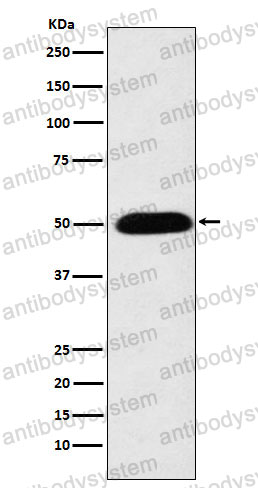Anti-CYP27A1 Antibody (R2C18)