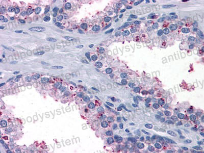 Anti-BDH1 Antibody (R3Q58)