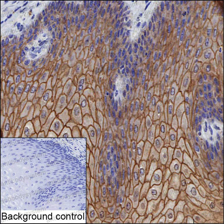 Anti-DSC2 Antibody (R3Q60)