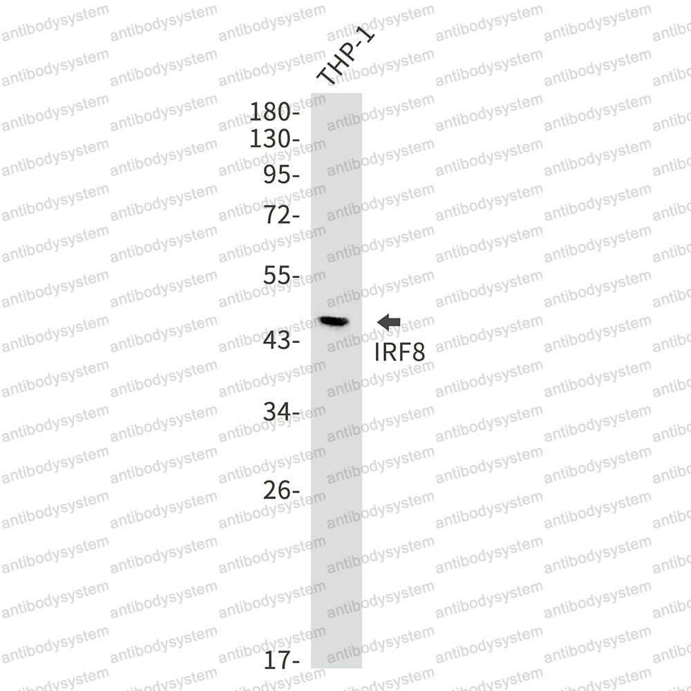 Anti-IRF8 Antibody (R2C19)