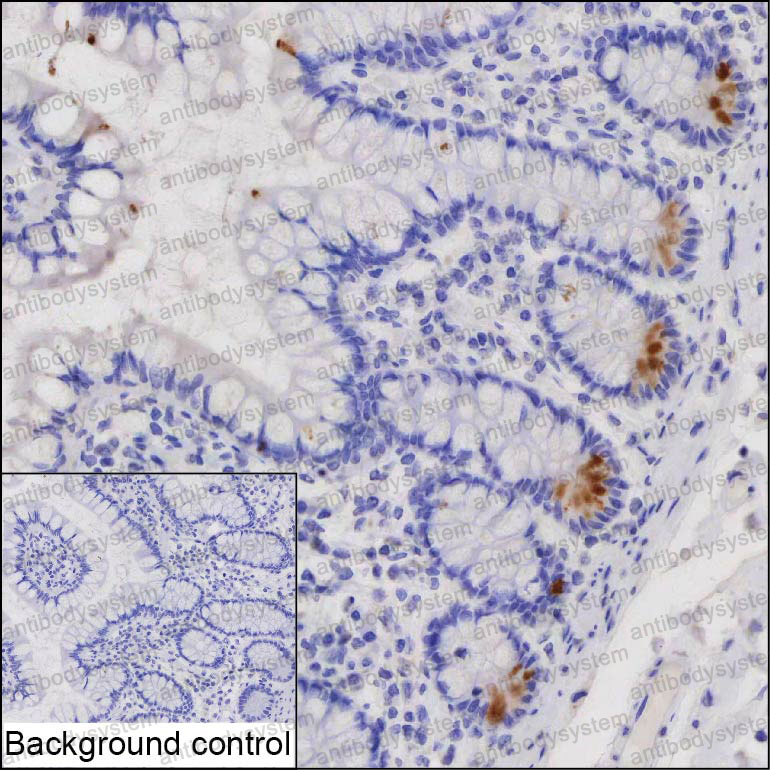 Anti-GUCA2A Antibody (R3Q65)