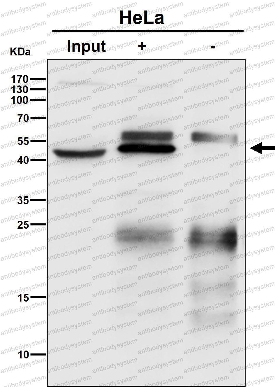 Anti-MAP2K1/MEK1 Antibody (R1A23)