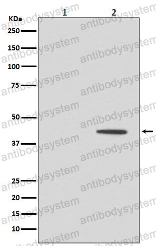 Anti-Phospho-MAP2K1/MEK1 (T292) Antibody (R2C21)