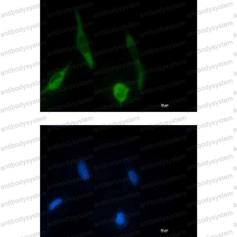 Anti-Phospho-MAP2K1/MEK1 (Ser298) Antibody (R2C22)