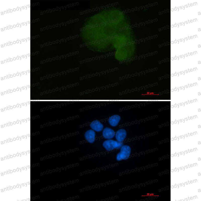 Anti-MAP2K1 Antibody (R2C24)