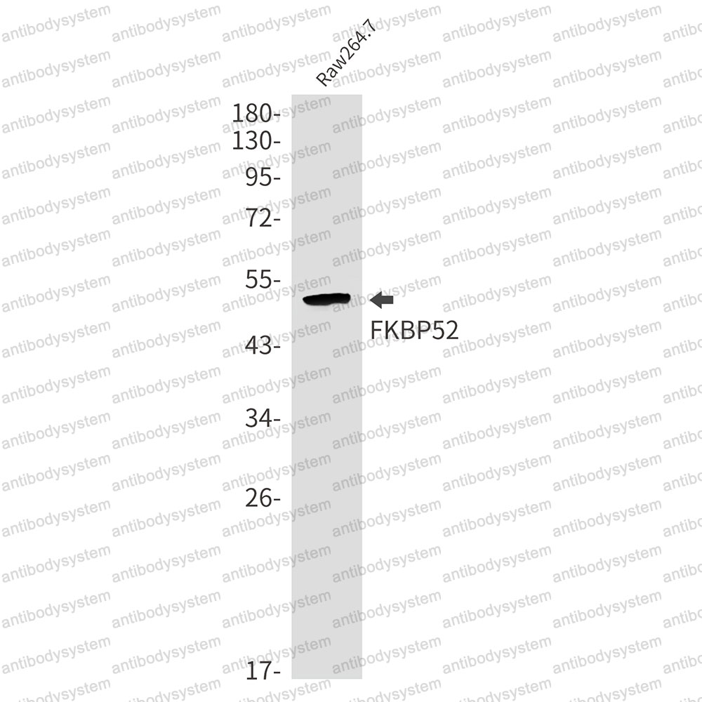 Western blot for Anti-FKBP4 Antibody (R2C27) ?>