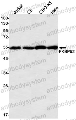 Western blot for Anti-FKBP4 Antibody (R2C27) ?>