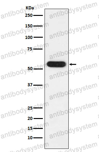 Anti-FKBP4 Antibody (R2C26)