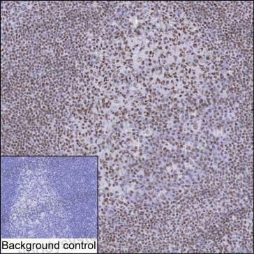 Anti-TOP2B Antibody (R3Q71)