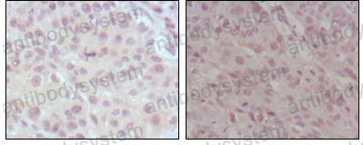 Anti-KMT2A/MLL Antibody (R3Q75)