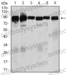 Anti-TGFBR3 Antibody (R3Q77)