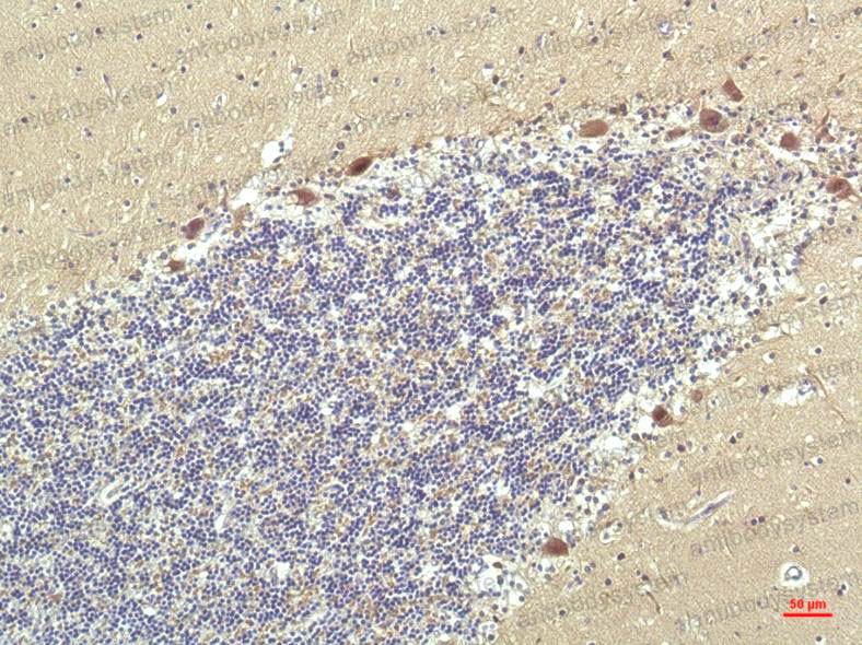 Anti-PPARD Antibody (R3Q78)